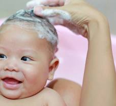 Így ápolja a babák korpás fejbőrét